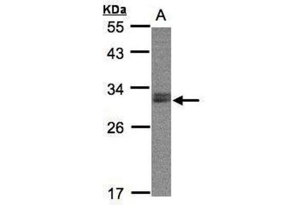 NSMCE1 antibody  (Center)