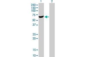 Western Blot analysis of AKT1 expression in transfected 293T cell line by AKT1 monoclonal antibody (M01), clone 4C3. (AKT1 antibody  (AA 381-480))