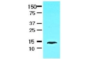 Western Blotting (WB) image for anti-Fatty Acid Binding Protein 1, Liver (FABP1) (AA 1-127), (N-Term) antibody (ABIN317519) (FABP1 antibody  (N-Term))