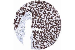 Strong Hepatocyte staining in hepatocytes while other structures of the liver remain negative (Hepatocyte Specific Antigen antibody)