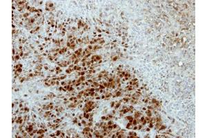 IHC-P Image Immunohistochemical analysis of paraffin-embedded SCM1 xenograft, using ARSA, antibody at 1:500 dilution. (ASNA1 antibody)