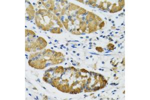 Immunohistochemistry of paraffin-embedded human stomach using PLA2G2D antibody (ABIN5974036) at dilution of 1/100 (40x lens). (PLA2G2D antibody)