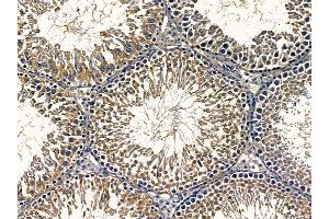 ABIN6257042 and ABIN6275505 at 1/100 staining rat testis tissue by IHC-P. (RIMKLA antibody  (Internal Region))