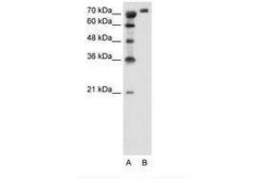 Image no. 2 for anti-Solute Carrier Family 6, Member 18 (SLC6A18) (AA 351-400) antibody (ABIN205030) (SLC6A18 antibody  (AA 351-400))
