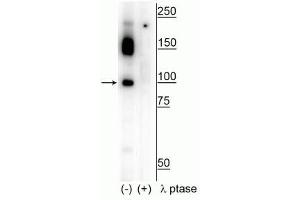 Western blot of human T47D cell lysate showing specific immunolabeling of the ~100 kDa CtIP phosphorylated at Ser326 in the first lane (-). (Retinoblastoma Binding Protein 8 antibody  (pSer326))