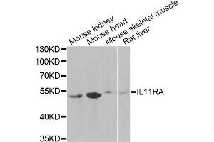Western blot analysis of extracts of various cell lines, using IL11RA Antibody (ABIN2563389) at 1:1000 dilution.