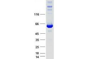 Validation with Western Blot (IMPDH1 Protein (Transcript Variant 2) (Myc-DYKDDDDK Tag))