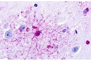 Image no. 1 for anti-G Protein-Coupled Receptor 84 (GPR84) (Transmembrane Domain) antibody (ABIN1048885) (GPR84 antibody  (Transmembrane Domain))