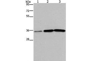 Western Blot analysis of Human testis tissue, A549 and PC3 cell using MAGEA3 Polyclonal Antibody at dilution of 1:400 (MAGEA3 antibody)
