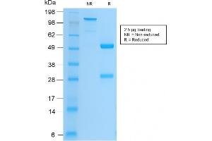 SDS-PAGE Analysis Purified CD61 Rabbit Recombinant Monoclonal Antibody (ITGB3/2166R). (Recombinant Integrin beta 3 antibody  (AA 385-490))