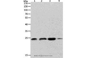 Western blot analysis of K562, 231 and Hela cell, Human fetal brain tissue, using RHOA Polyclonal Antibody at dilution of 1:400