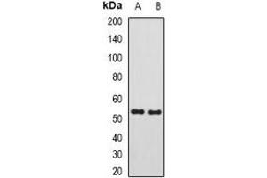 Western blot analysis of SUFU expression in mouse testis (A), rat kidney (B) whole cell lysates. (SUFUH antibody)