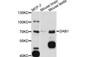Western blot analysis of extracts of various cell lines, using DAB1 antibody (ABIN5997560) at 1/1000 dilution. (DAB1 antibody)
