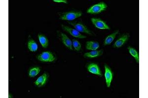 Immunofluorescent analysis of A549 cells using ABIN7170725 at dilution of 1:100 and Alexa Fluor 488-congugated AffiniPure Goat Anti-Rabbit IgG(H+L) (STMN2 antibody  (AA 61-129))