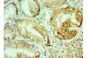Immunohistochemistry of paraffin-embedded human prostate tissue using ABIN7148222 at dilution of 1:100