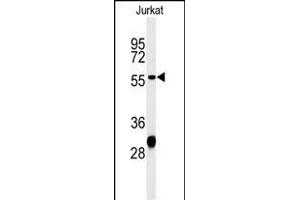 Western blot analysis of HADHB Antibody (C-term) (ABIN653816 and ABIN2843089) in Jurkat cell line lysates (35 μg/lane).