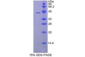 SDS-PAGE (SDS) image for Natriuretic Peptide A (NPPA) (AA 25-122) protein (His tag,GST tag) (ABIN1169925)