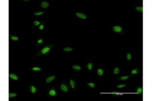 Immunofluorescence of monoclonal antibody to OLIG2 on HeLa cell. (OLIG2 antibody  (AA 2-78))