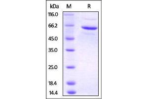 Human FKBP4, His Tag & PA Tag on SDS-PAGE under reducing (R) condition. (FKBP4 Protein (AA 1-459) (His tag,PA tag))