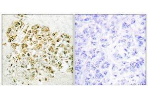 Immunohistochemistry (IHC) image for anti-Myeloid Zinc Finger 1 (MZF1) (N-Term) antibody (ABIN1849291) (MZF1 antibody  (N-Term))