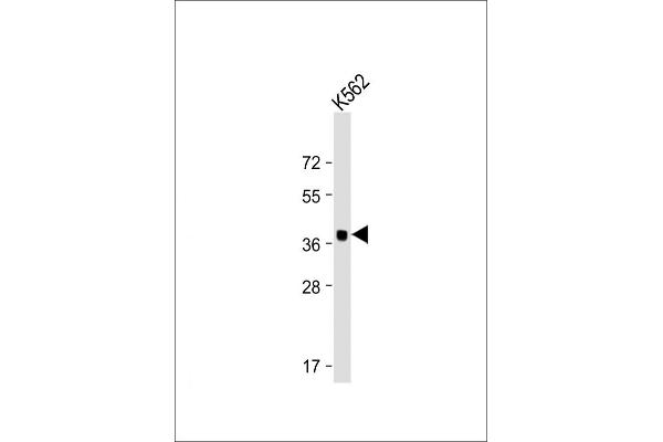 YOD1 antibody  (C-Term)