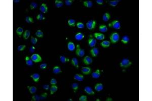 Immunofluorescence staining of Hela cells with ABIN7167342 at 1:166, counter-stained with DAPI. (RAB42 antibody  (AA 1-105))