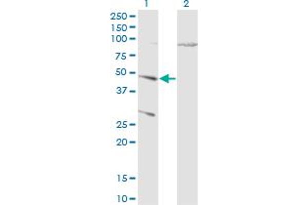 Cathepsin D antibody  (AA 26-412)