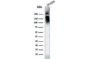 Western Blotting (WB) image for anti-Protein tyrosine Phosphatase, Receptor Type, C (PTPRC) antibody (ABIN6940461)