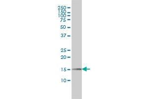 PIN1 monoclonal antibody (M01), clone 2F2 Western Blot analysis of PIN1 expression in Jurkat . (PIN1 antibody  (AA 64-163))