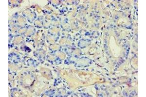 Immunohistochemistry of paraffin-embedded human pancreatic tissue using ABIN7144294 at dilution of 1:100 (Annexin VII antibody  (AA 259-488))