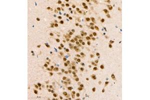 Immunohistochemistry of paraffin embedded mouse brain using COPS2 (ABIN7073324) at dilution of 1:1400 (400x lens) (CSN2 antibody)