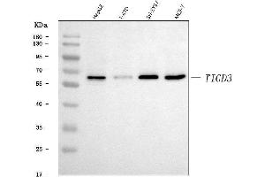 Western blot analysis of TIGD3 using anti-TIGD3 antibody (ABIN7599914).