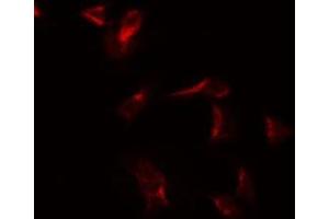 ABIN6275884 staining COLO205 by IF/ICC. (CSF2RA antibody  (Internal Region))