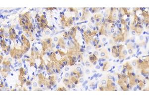 Detection of MCP1 in Porcine Stomach Tissue using Polyclonal Antibody to Monocyte Chemotactic Protein 1 (MCP1) (CCL2 antibody  (AA 24-99))