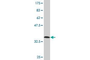 Western Blot detection against Immunogen (36. (ISL2 antibody  (AA 261-358))