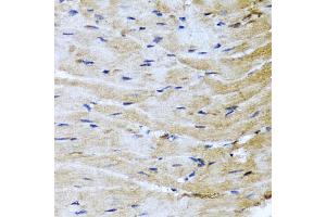 Immunohistochemistry of paraffin-embedded mouse heart using M6PR antibody (ABIN5975018) at dilution of 1/100 (40x lens).
