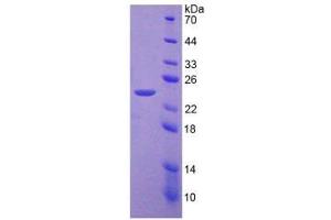Image no. 1 for phosphoenolpyruvate Carboxykinase 2 (Mitochondrial) (PEPCK) (AA 33-198) protein (His tag) (ABIN4989860)