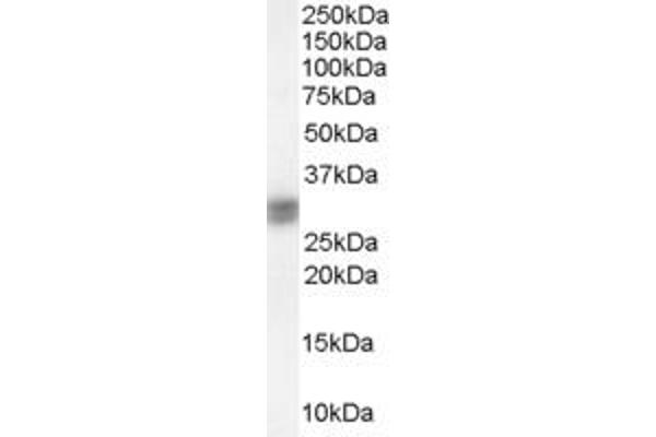 SIAH1 antibody  (N-Term)