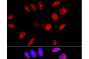Confocal immunofluorescence analysis of U-2 OS cells using Ataxin 3 Polyclonal Antibody at dilution of 1:100. (Ataxin 3 antibody)