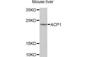Western blot analysis of extracts of Mouse liver cells, using ACP1 antibody. (ACP1 antibody)