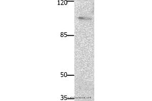 Western blot analysis of Mouse brain tissue, using PTK2 Polyclonal Antibody at dilution of 1:1850 (FAK antibody)