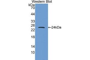 Western Blotting (WB) image for anti-Myosin Heavy Chain 6, Cardiac Muscle, alpha (MYH6) (AA 1747-1938) antibody (ABIN1859930) (MYH6 antibody  (AA 1747-1938))