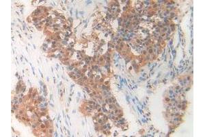 Figure. (PDXK antibody  (AA 29-253))