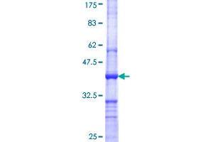 CARM1 Protein (AA 284-381) (GST tag)