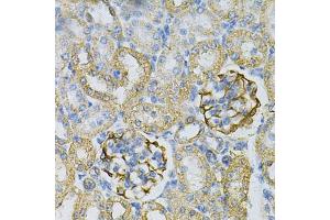Immunohistochemistry of paraffin-embedded rat kidney using  Antibody (ABIN6127328, ABIN6136696, ABIN6136697 and ABIN6217467) at dilution of 1:100 (40x lens). (Adenylate Kinase 1 antibody  (AA 1-194))