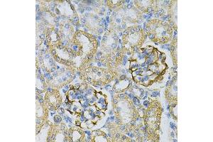 Immunohistochemistry of paraffin-embedded rat kidney using  Antibody (ABIN6127328, ABIN6136696, ABIN6136697 and ABIN6217467) at dilution of 1:100 (40x lens). (Adenylate Kinase 1 antibody  (AA 1-194))
