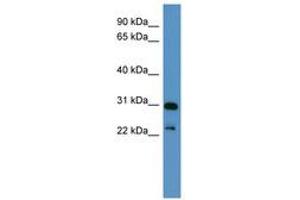 Image no. 1 for anti-Paired-Like Homeobox 2a (PHOX2A) (C-Term) antibody (ABIN6746154) (PHOX2A antibody  (C-Term))