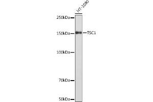 Western blot analysis of extracts of HT-1080 cells, using TSC1 Rabbit mAb (ABIN1678705, ABIN7101763, ABIN7101764 and ABIN7101765) at 1:1000 dilution. (TSC1 antibody)