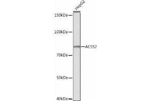 Western blot analysis of extracts of HepG2 cells, using  Rabbit mAb (ABIN7265427) at 1:1000 dilution. (ACSS2 antibody)