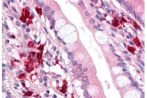 Anti-TFF2 antibody  ABIN1049400 IHC staining of human small intestine. (Trefoil Factor 2 antibody  (Internal Region))
